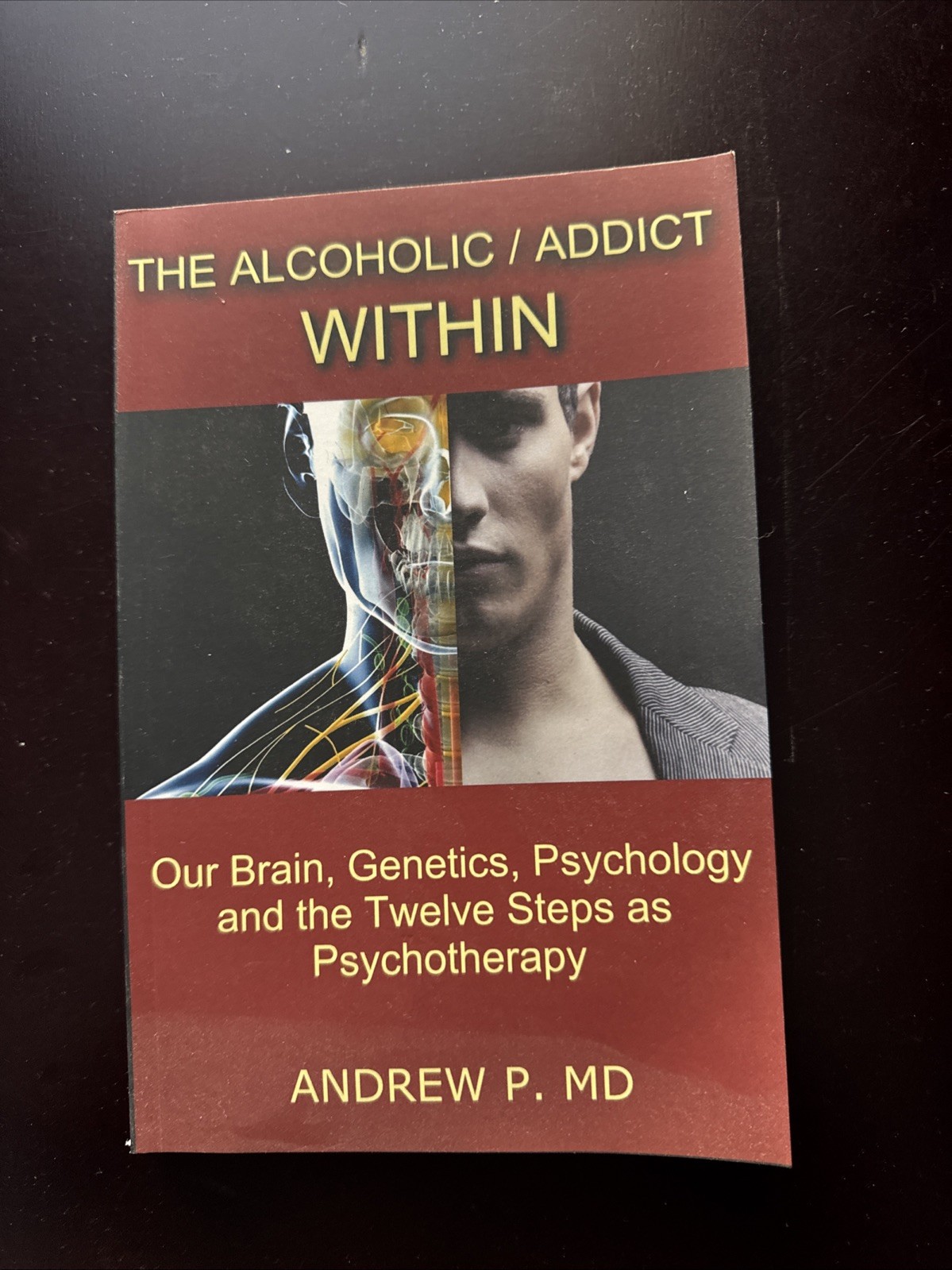 Alcoholic / Addict Within : Our Brain, Genetics, Psychology and the Twelve Steps