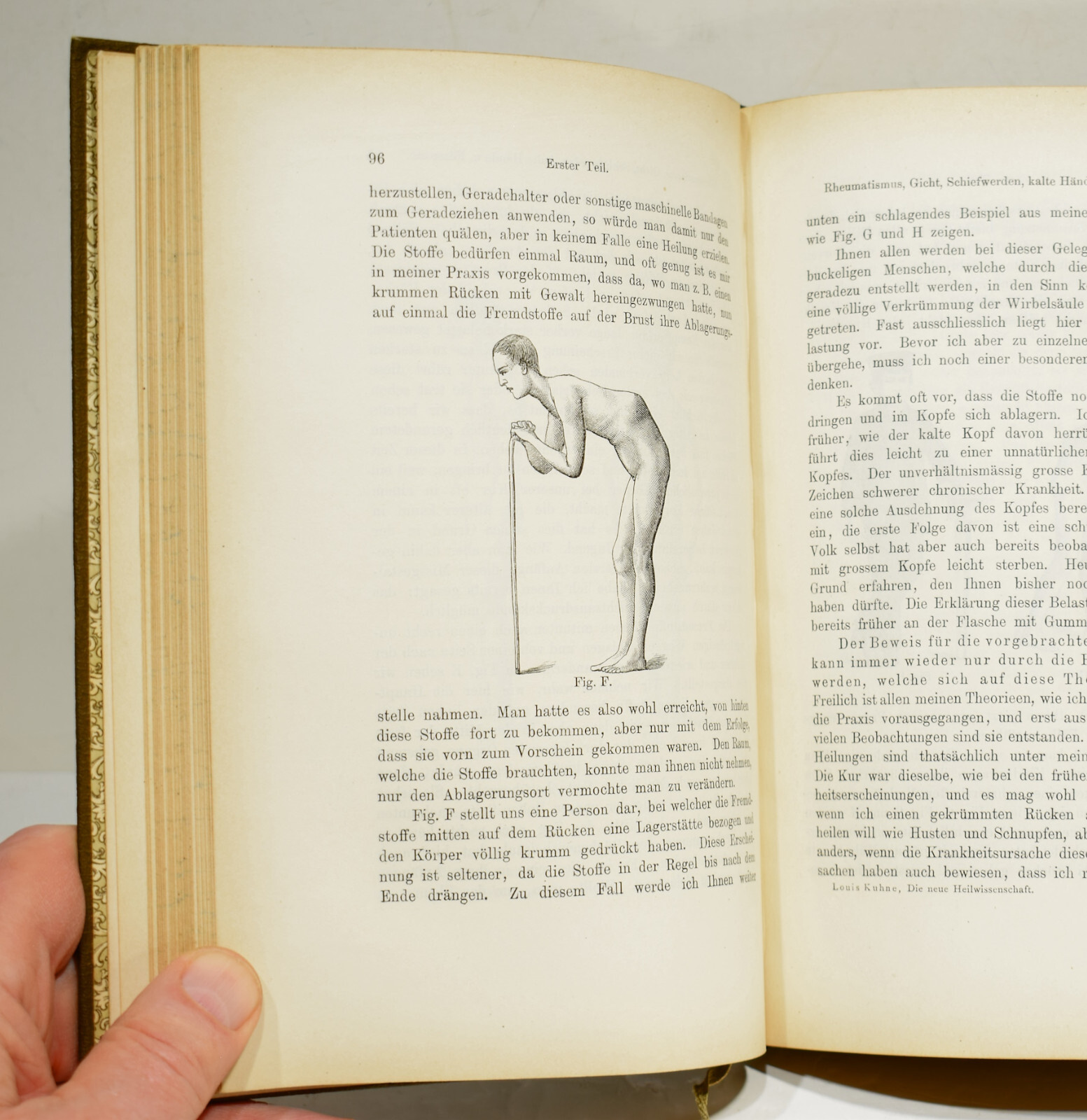 DIE NEUE HEILWISSENSCHAFT by Louis Kuhne 1896 Early German Naturopathy Text