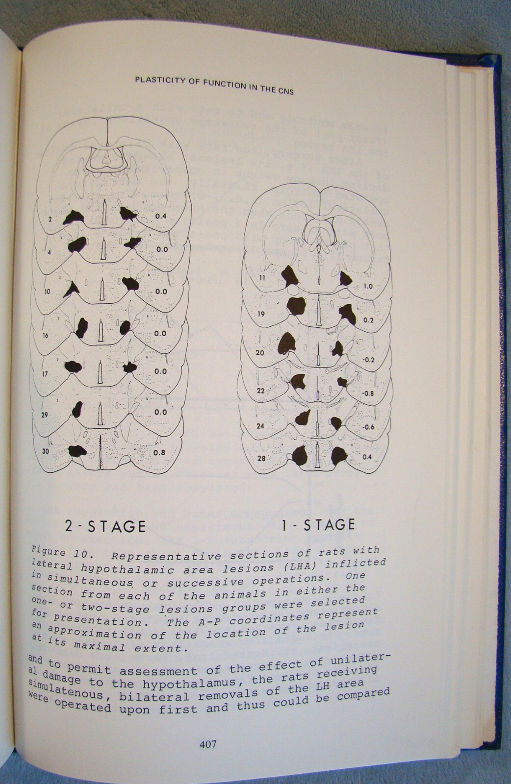 Plasticity And Recovery Of Function In The Central Nervous System ~1974 HC~ Eye