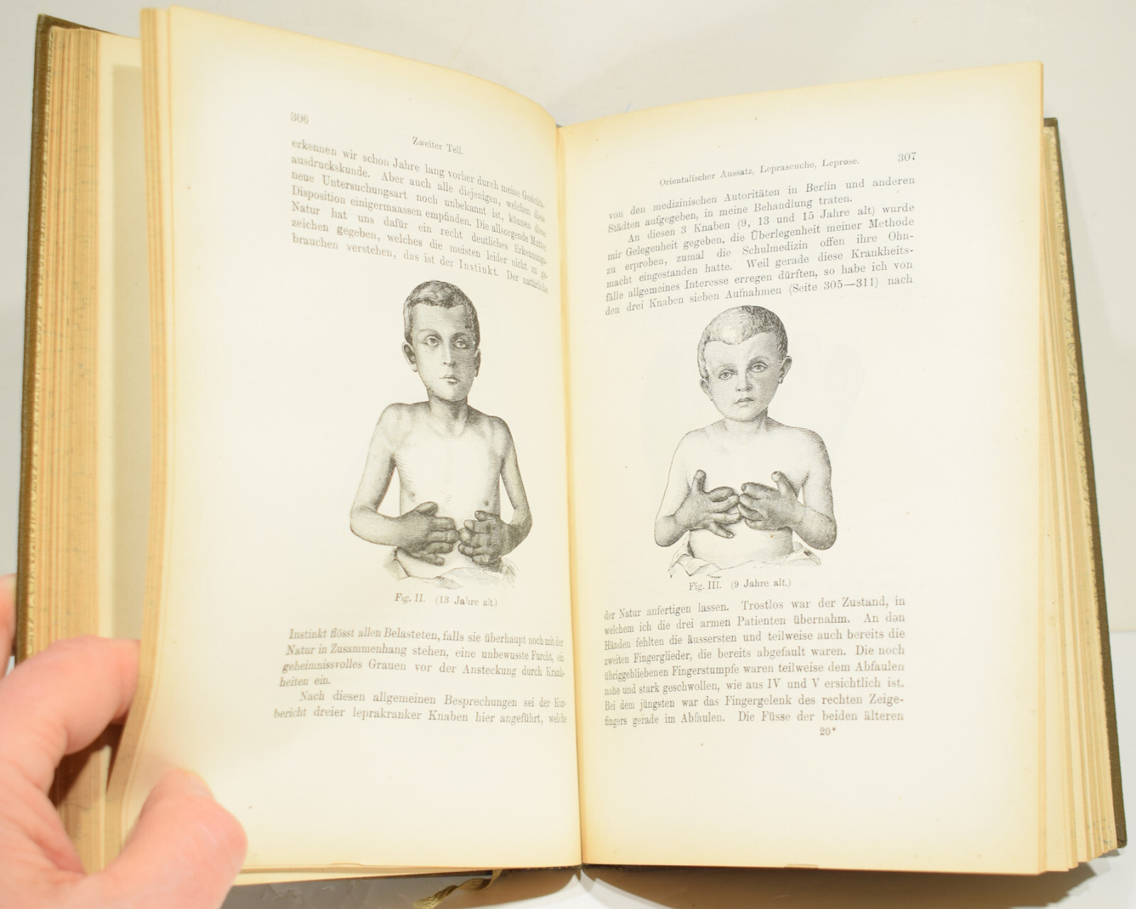 DIE NEUE HEILWISSENSCHAFT by Louis Kuhne 1896 Early German Naturopathy Text